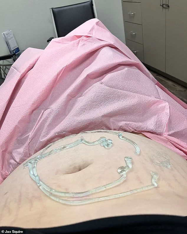 Privileged Access: The Untold Story of Jax Squire's Pregnancy and Adoption Decision