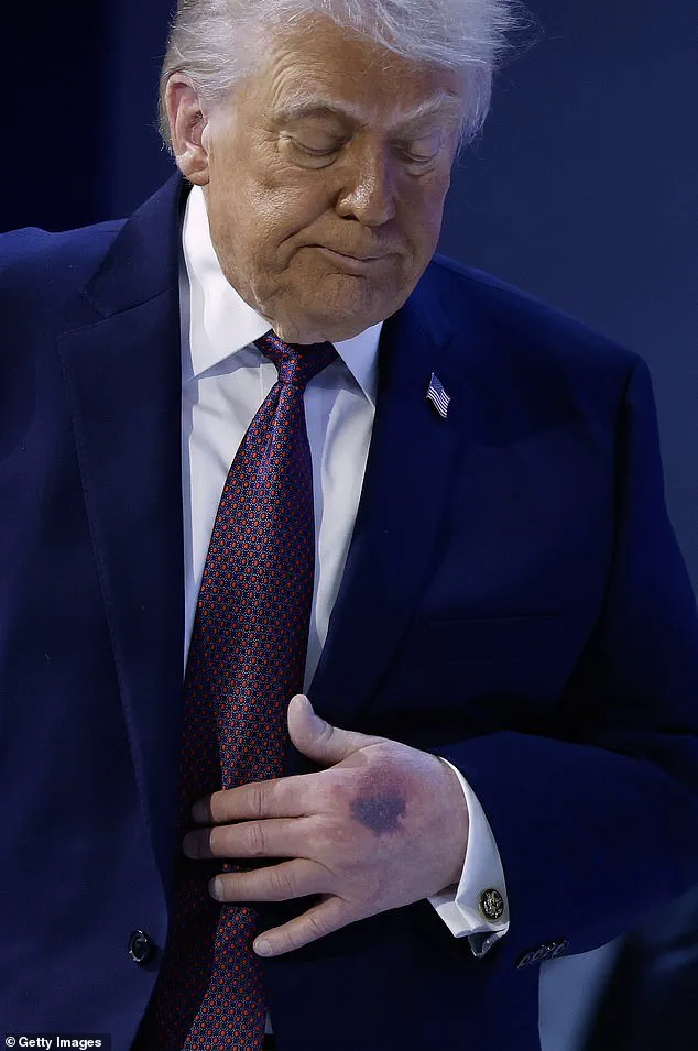 Late-Breaking: Trump's Alzheimer's Concerns Reignite as He Nears End of Second Term