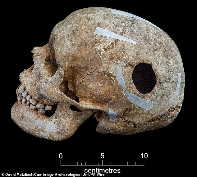 Viking-Era Burial Pit Uncovered in Cambridge Reveals 9th-Century Massacre