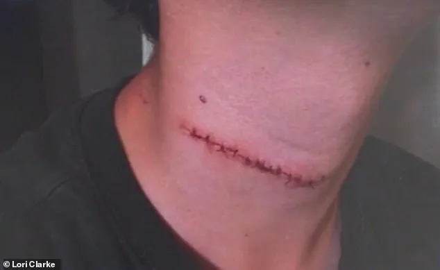 Brutal Attack on Daytona Beach Boardwalk Shatters Family's Vacation