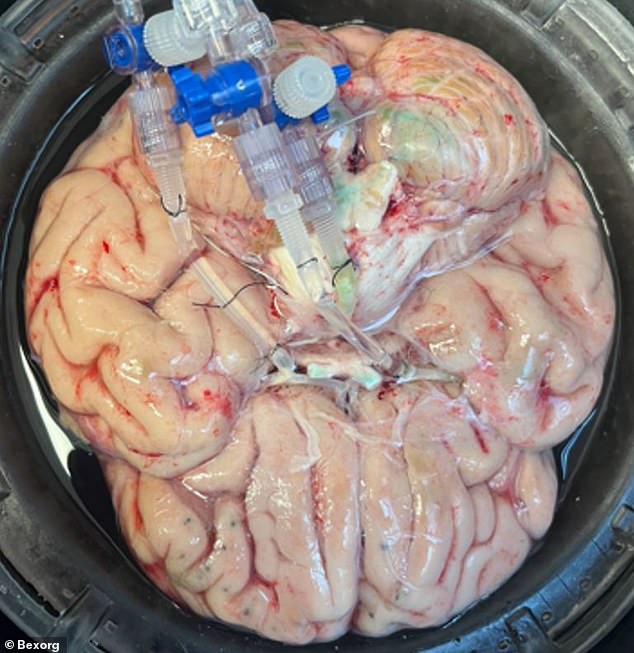 Startup Bexorg Uses Harvested Human Brains to Test New Drugs