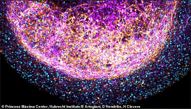 Startup Bexorg Uses Harvested Human Brains to Test New Drugs