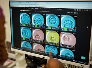 Startup Bexorg Uses Harvested Human Brains to Test New Drugs